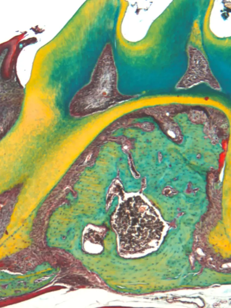 recherche-histologie-regeneration-osseuse-1200 Coupe histologique colorée au pentachrome : dent et os alvéolaire