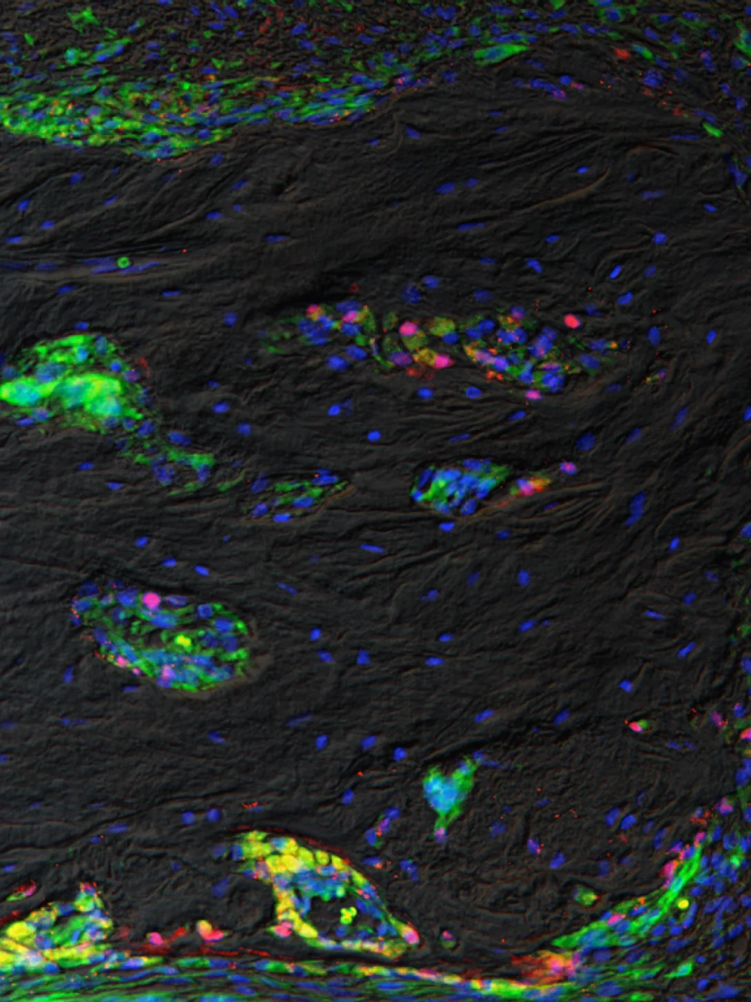 recherche-immunofluorescence-osteointegration-1090 Immunofluorescence d’un tissu osseux en cours de cicatrisation